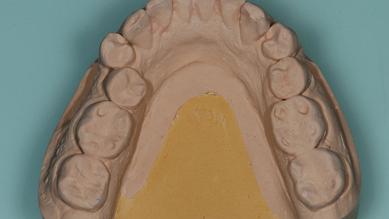 Gnatologia | Studio Odontoiatrico Dr. Colombo Bolla - Dr. Brivio