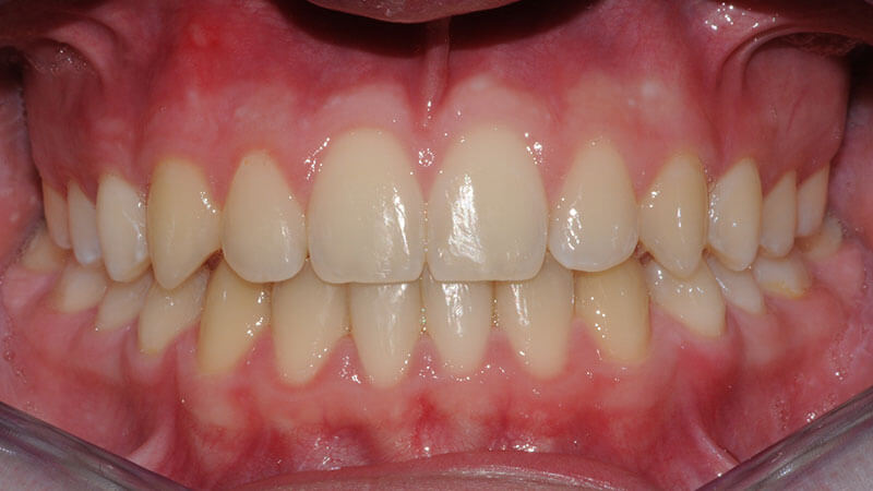 Ortodonzia | Studio Odontoiatrico Dr. Colombo Bolla - Dr. Brivio