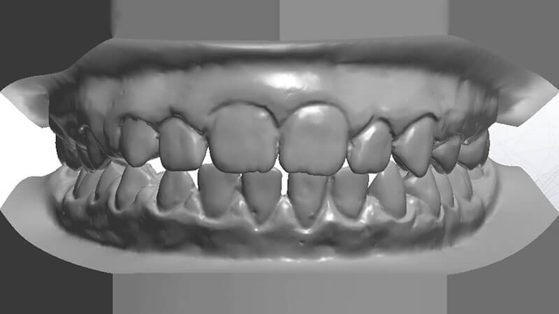 Ortodonzia | Studio Odontoiatrico Dr. Colombo Bolla - Dr. Brivio