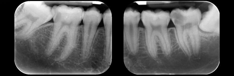 Radiologia dentale | Studio Odontoiatrico Dr. Colombo Bolla - Dr. Brivio