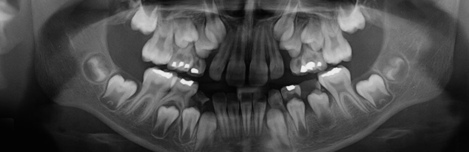 Radiologia dentale | Studio Odontoiatrico Dr. Colombo Bolla - Dr. Brivio